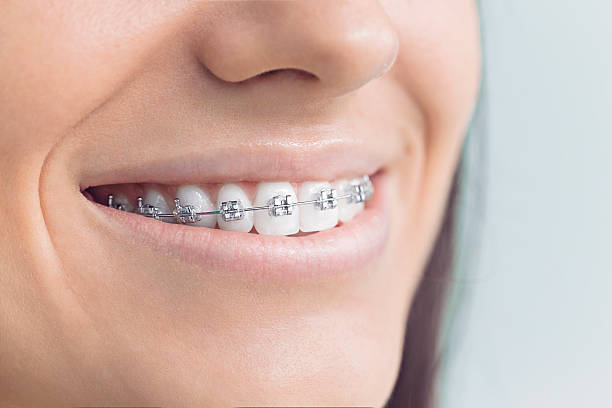 Full Mouth Reconstruction in Rockford, MI